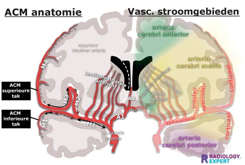 Interventieradiologie - De CVA Patient